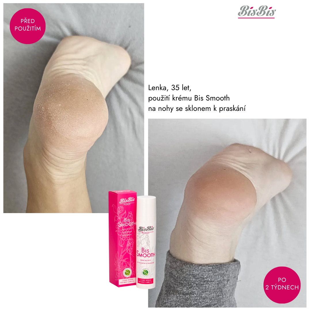 Smooth před po Lenka